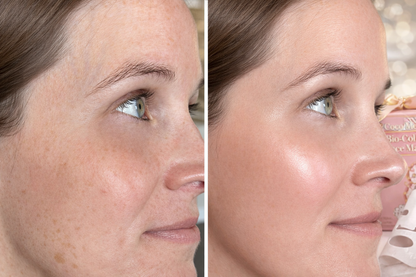 Coco Skin (20 Pack + Serum)